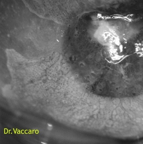 PUNTATO INIZIALMENTE IRREGOLARE VISIONE IN BIANCO E NERO