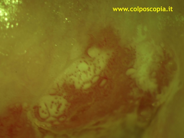 PARTICOLARE PUNTATO IRREGOLARE CIN3 CON FILTRO VERDE