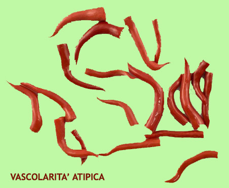 IRREGOLARE RAMIFICAZIONE VASCOLARE