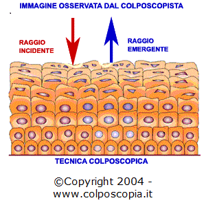 EPITELIO CERVICE UTERINA DR.VACCARO